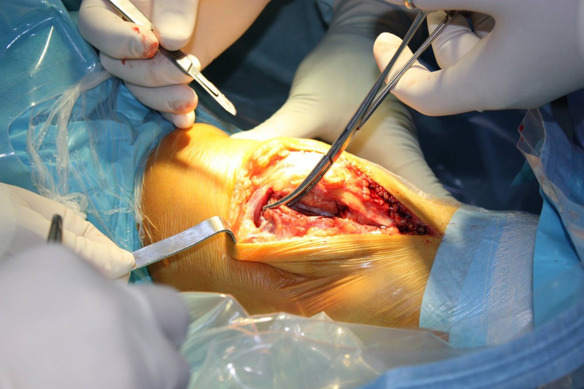 spital operatie Ortopedie-Traumatologie (2)