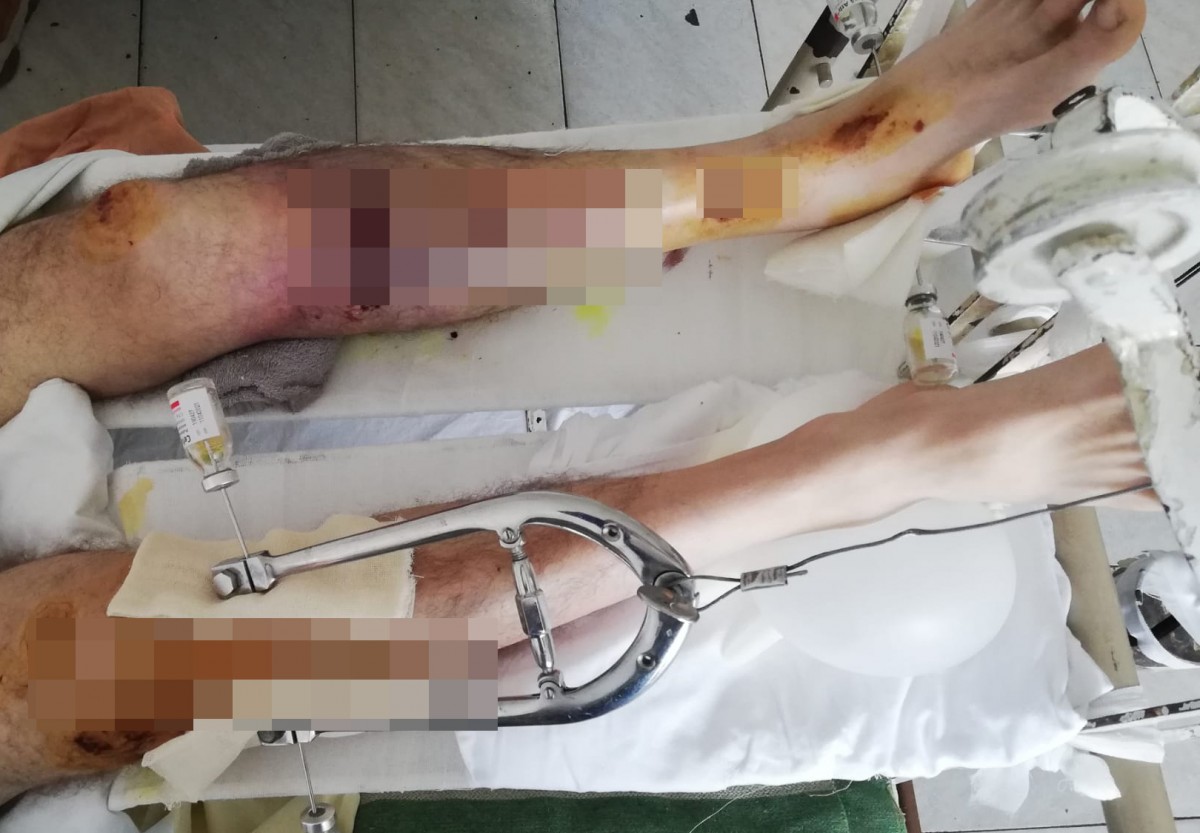 ranit spital accident (3)