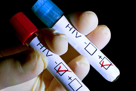 Ziua mondială de luptă împotriva SIDA: Originea secretă a HIV