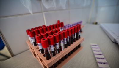 Spitalul solicită sprijinul populaţiei în vederea donării de sânge. Specialiștii spun că măsura este sigură în contextul epidemiologic actual