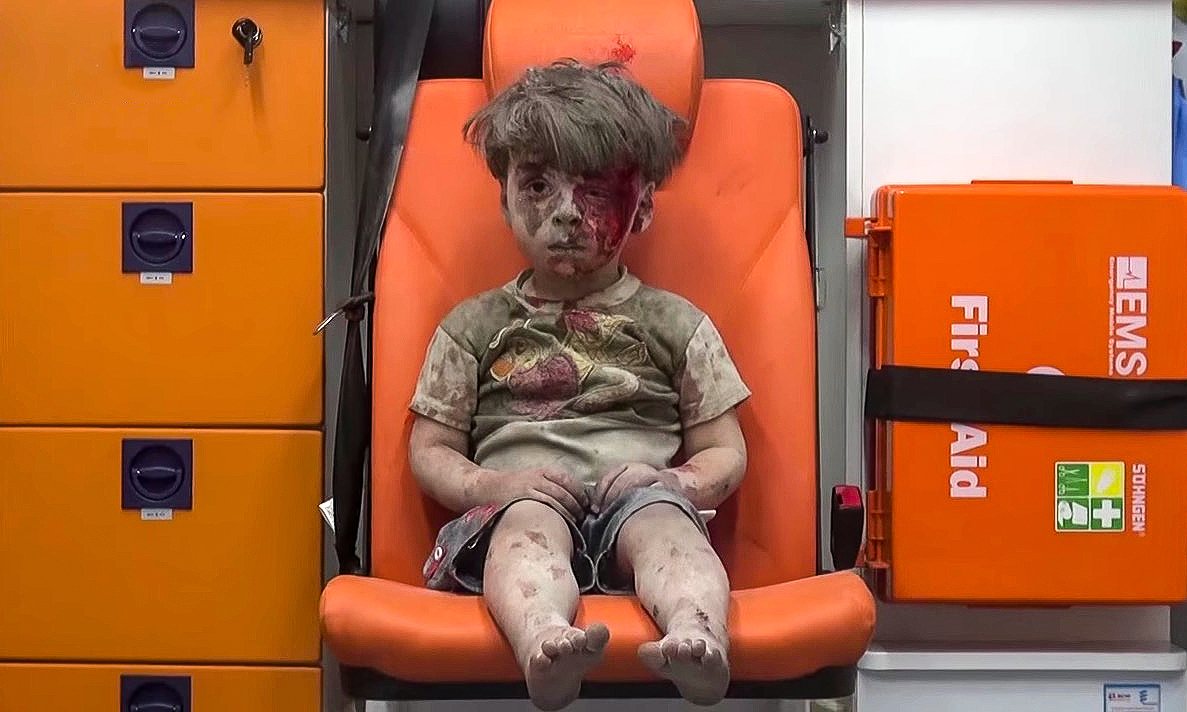 VIDEO. Micul Omran a devenit imaginea simbol a suferinţei copiilor din Alep