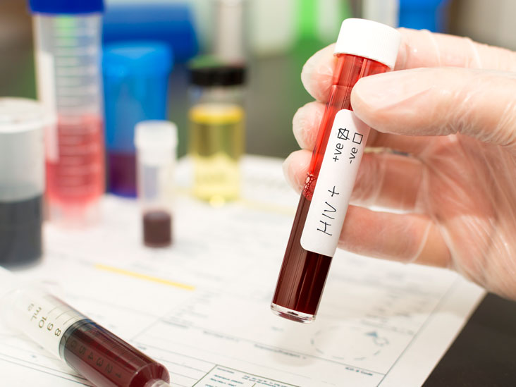 Viața cu HIV. „Mi-e teamă că voi fi marginalizat”