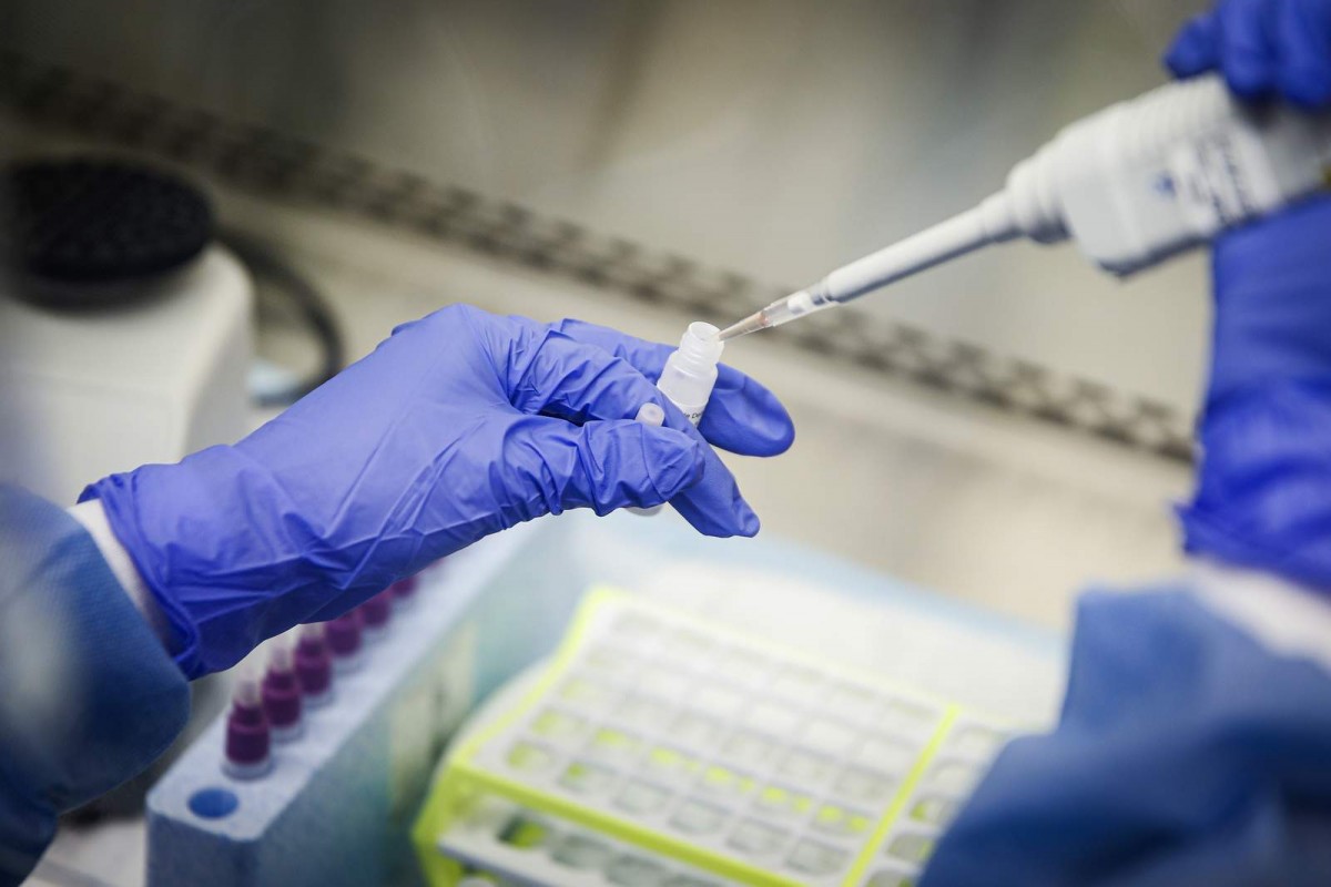 Un medicament pe bază de interferon beta ar reduce riscul de a dezvolta o formă severă de COVID-19 cu 79%