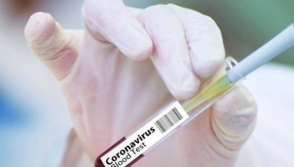 România: 1.470 cazuri noi de coronavirus și 44 decedați