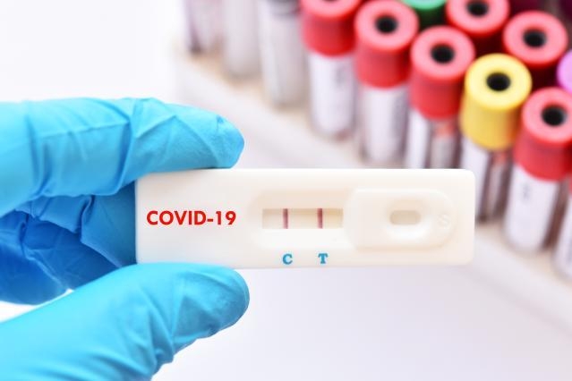 Franţa nu va mai testa gratuit persoanele nevaccinate anti-Covid
