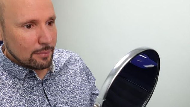 Un britanic urmează să primească primul ochi printat la o imprimantă 3D. Aces proces reduce la jumătate fabricarea normală a unui ochi artificial