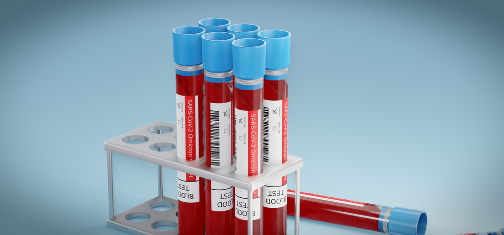 Varianta Omicron reprezintă 40% din totalul infectărilor din Londra