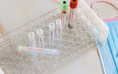 OMS: Nicio variantă a coronavirusului nu s-a răspândit până acum la fel de rapid ca Omicron