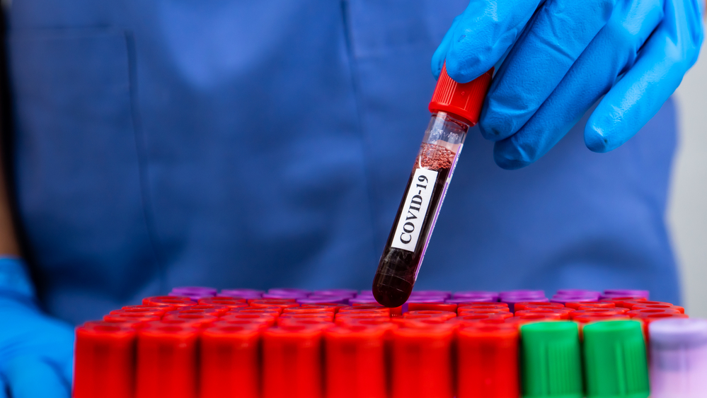 CNSU a actualizat lista țărilor de risc epidemiologic ridicat: Franța și Portugalia au intrat în zona roșie