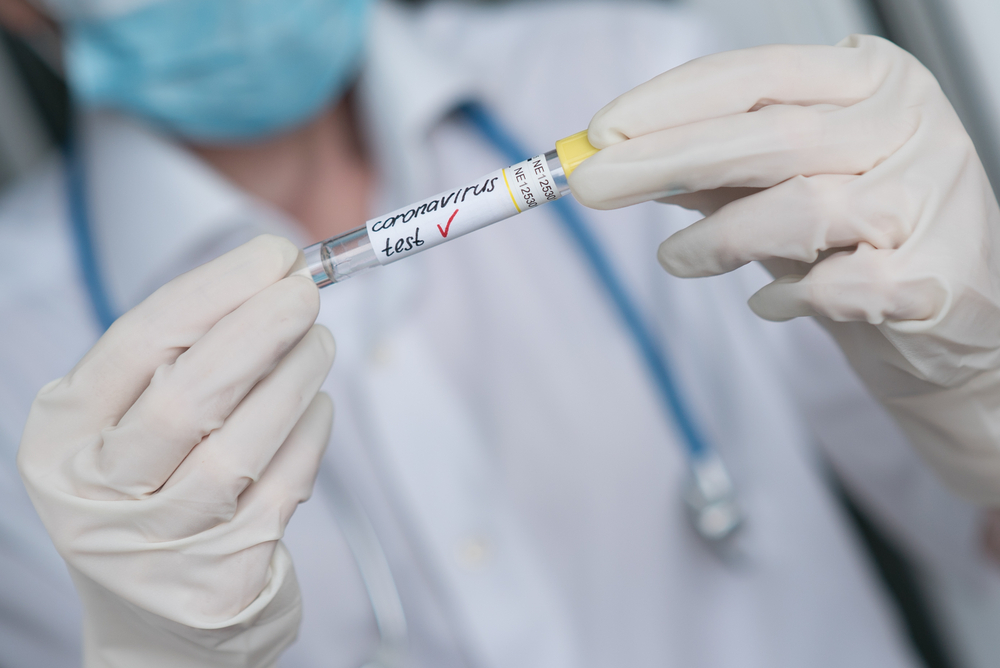 89 de sibieni internați, 2.242 de cazuri active în județ. Media cazurilor zilnice din ianuarie: 159