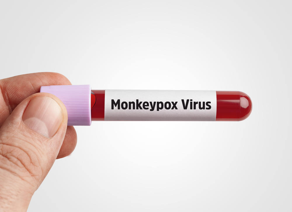 OMS va folosi termenul de „mpox” în loc de variola maimuţei pentru a combate stigmatizarea
