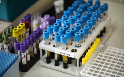 INSP: În săptămâna 7 - 13 februarie, 50,6% dintre cazurile de COVID-19 au fost la persoane nevaccinate