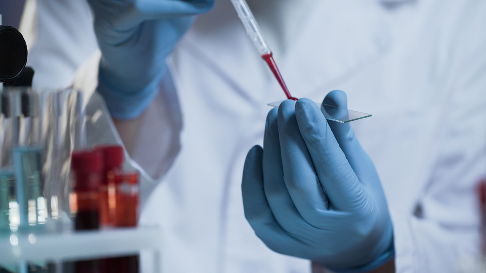 Ministrul Sănătății: există o creştere a infectărilor cu SARS-CoV-2 în oraşele mari. Monitorizăm cu atenție