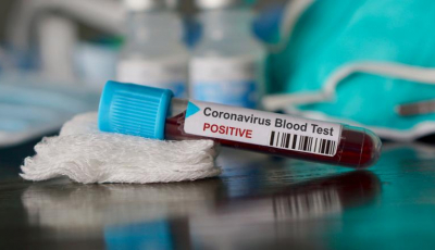 Bilanț COVID-19, în România, vineri: 5.602 cazuri noi, 65 decese și 47.117 teste