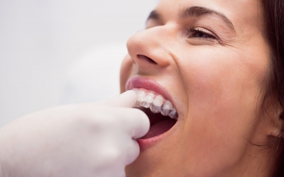 Ce alimente să eviți atunci când porți aparat dentar
