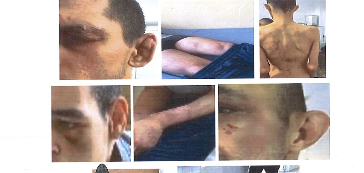 Actualizare Fake-news al deputatului Marius Vulcan. Semnalează nereguli la un spital de psihiatrie din Bihor, ”unde sunt duși pacienții din Sibiu”. DSP: Pacienții din județ sunt duși în Timiș. Reacția deputatului