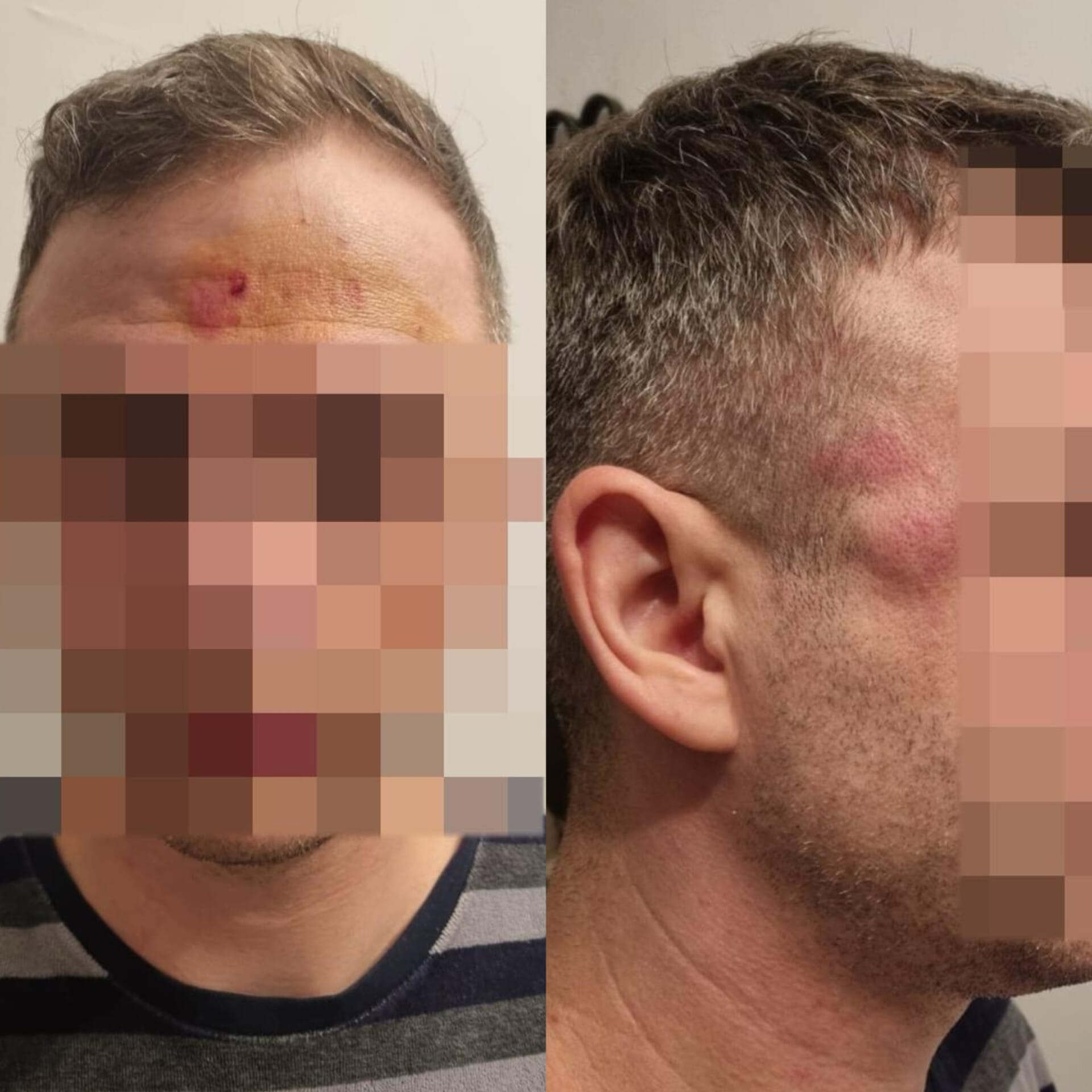 Un sibian bătut și tâlhărit de Crăciun așteaptă și acum ca autoritățile să-i rezolve cazul. „În tot acest timp eu sunt hărțuit și amenințat cu moartea”