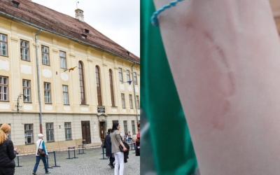 Un copil de 15 ani, agresat într-o școală din Sibiu, a ales să vorbească: „M-a mușcat până mi-a lăsat semn și apoi mi-a spus că a glumit”