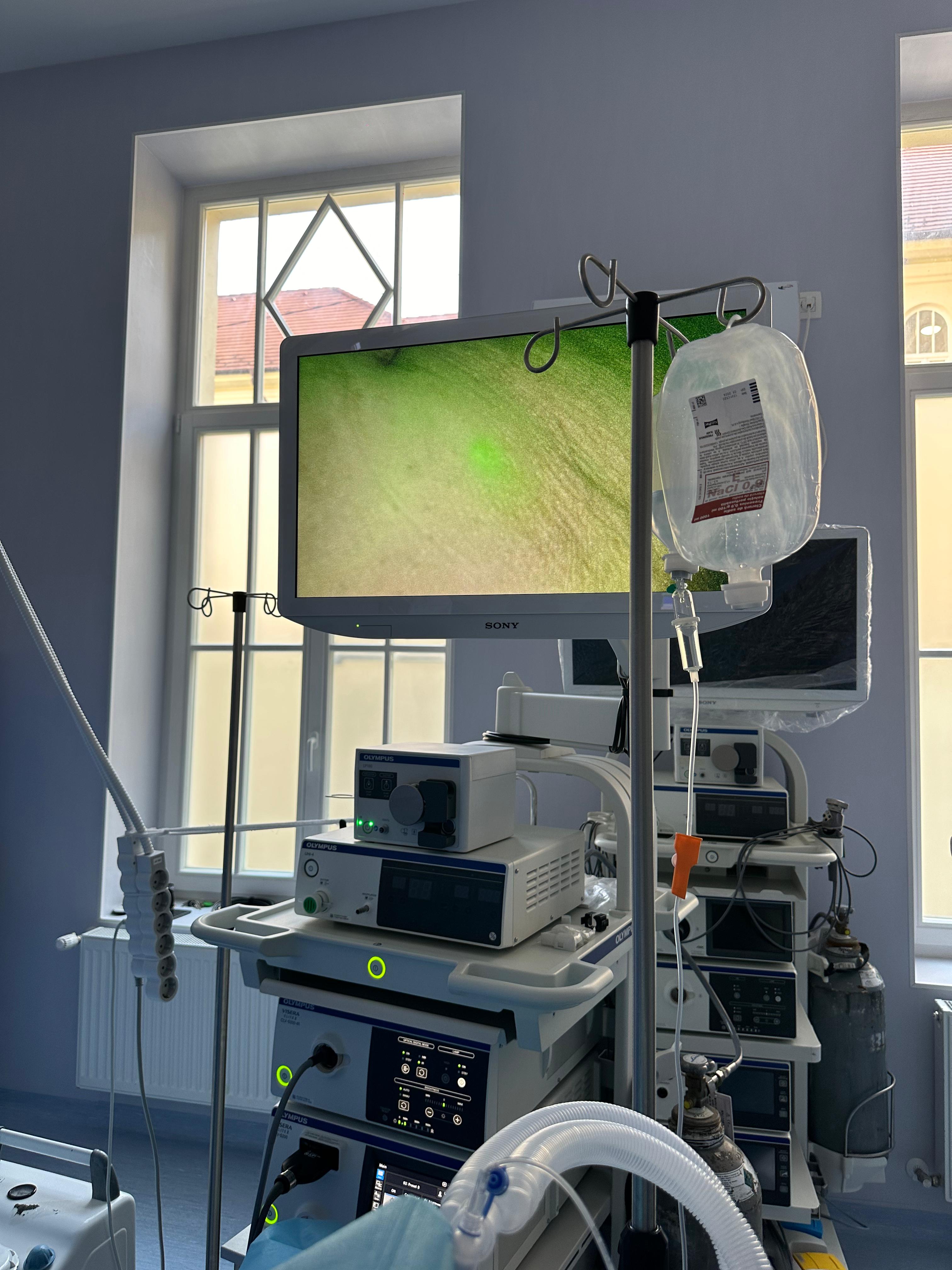 Intervenții minim invazive asupra cancerului de sân, cu aparatură ultramodernă la Spitalul Județean Sibiu
