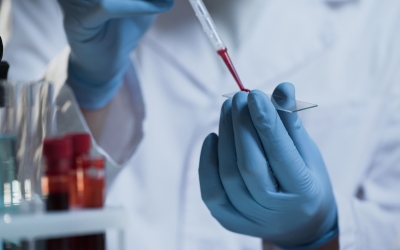 OMS: Primul deces uman din cauza gripei aviare de tip H5N2