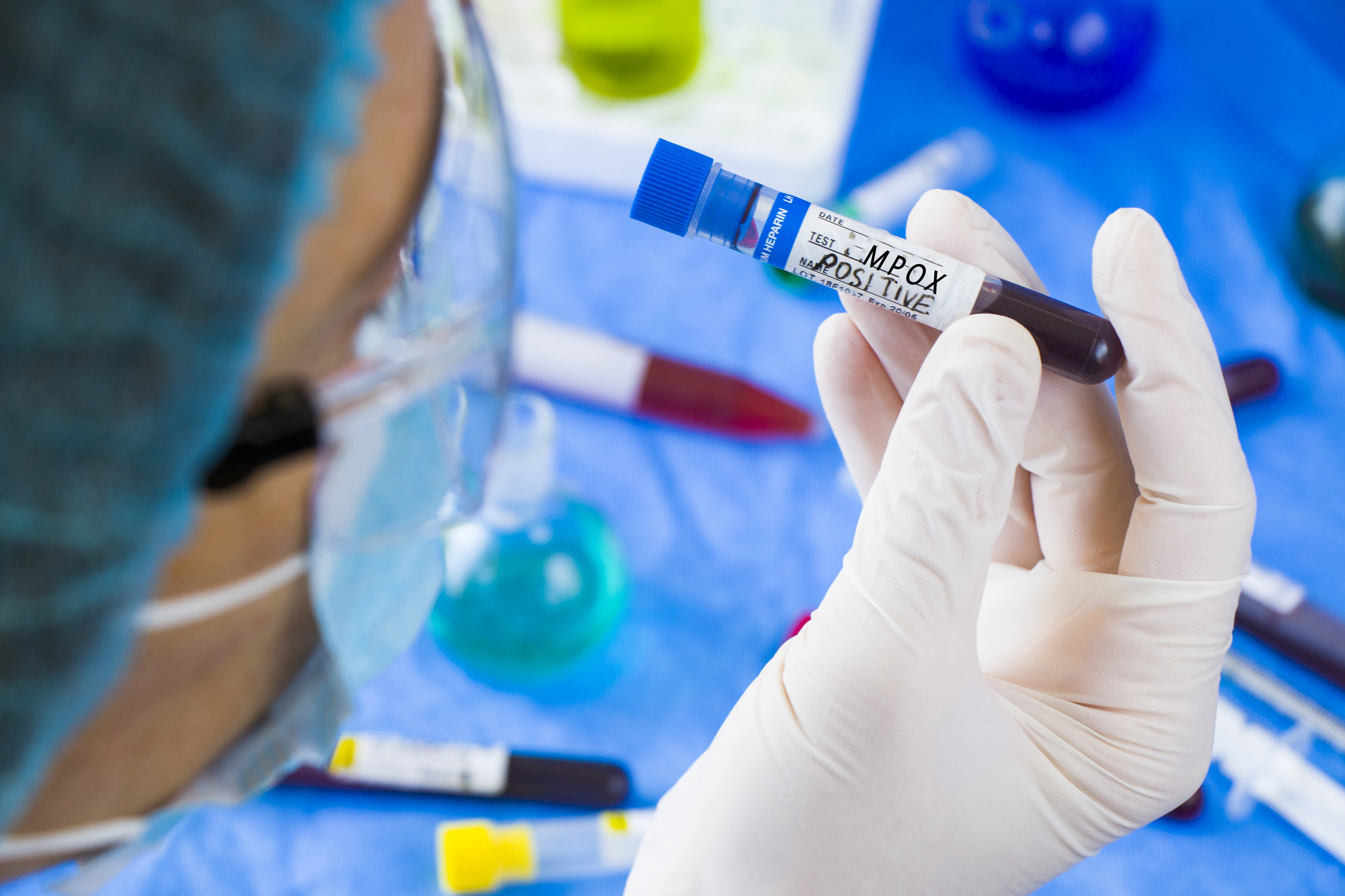 Autoritatea sanitară europeană se aşteaptă ca mai mulţi oameni să pătrundă pe continent cu mpox