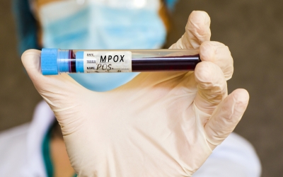 Compania Bavarian Nordic solicită aprobarea UE pentru folosirea vaccinului său anti mpox pe copii şi adolescenţi