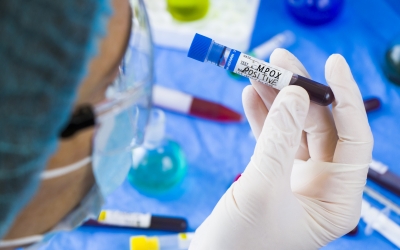 Autoritatea sanitară europeană se aşteaptă ca mai mulţi oameni să pătrundă pe continent cu mpox