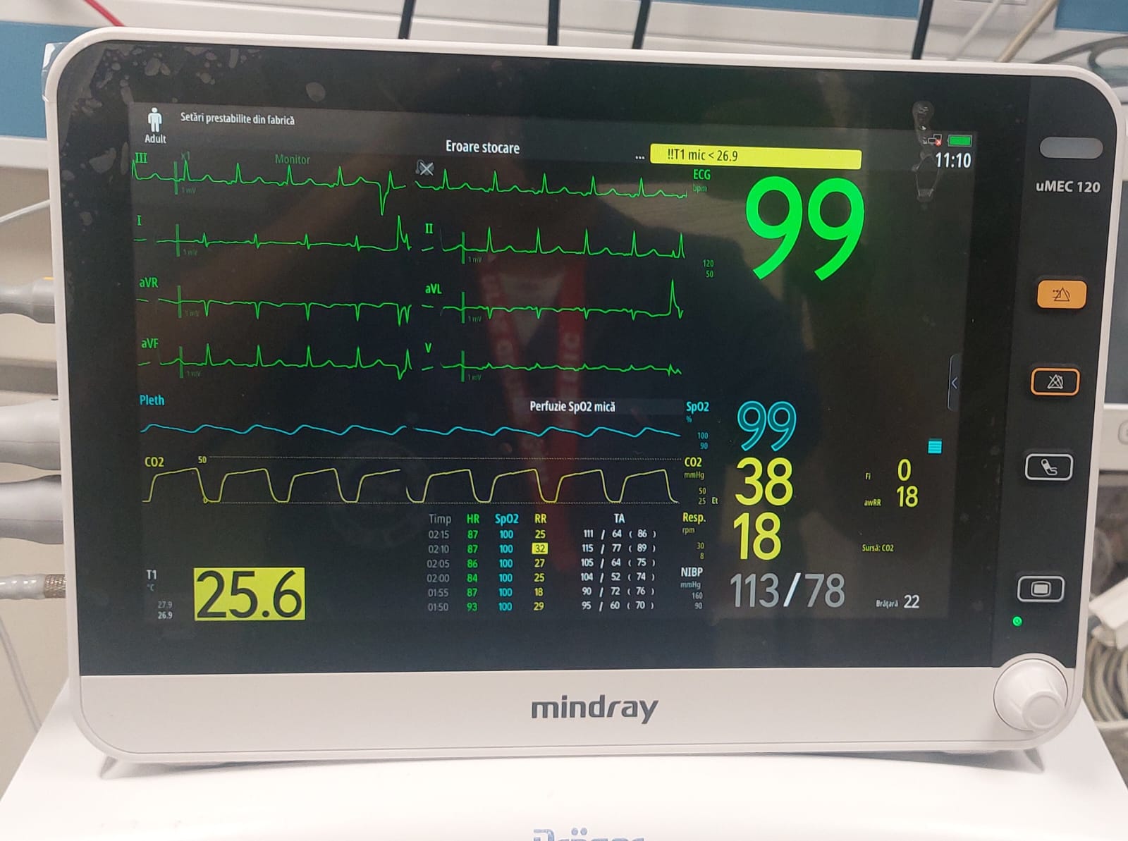 Camera de Resuscitare a UPU Sibiu a fost dotată cu un aparat ultraperformant. Va ajuta la salvarea vieților pacienților