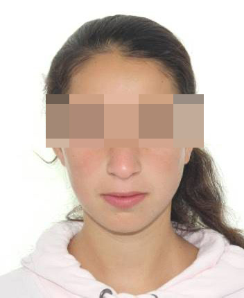 Actualizare. Adolescenta de 16 ani plecată de acasă de 2 luni a fost găsită în Alba