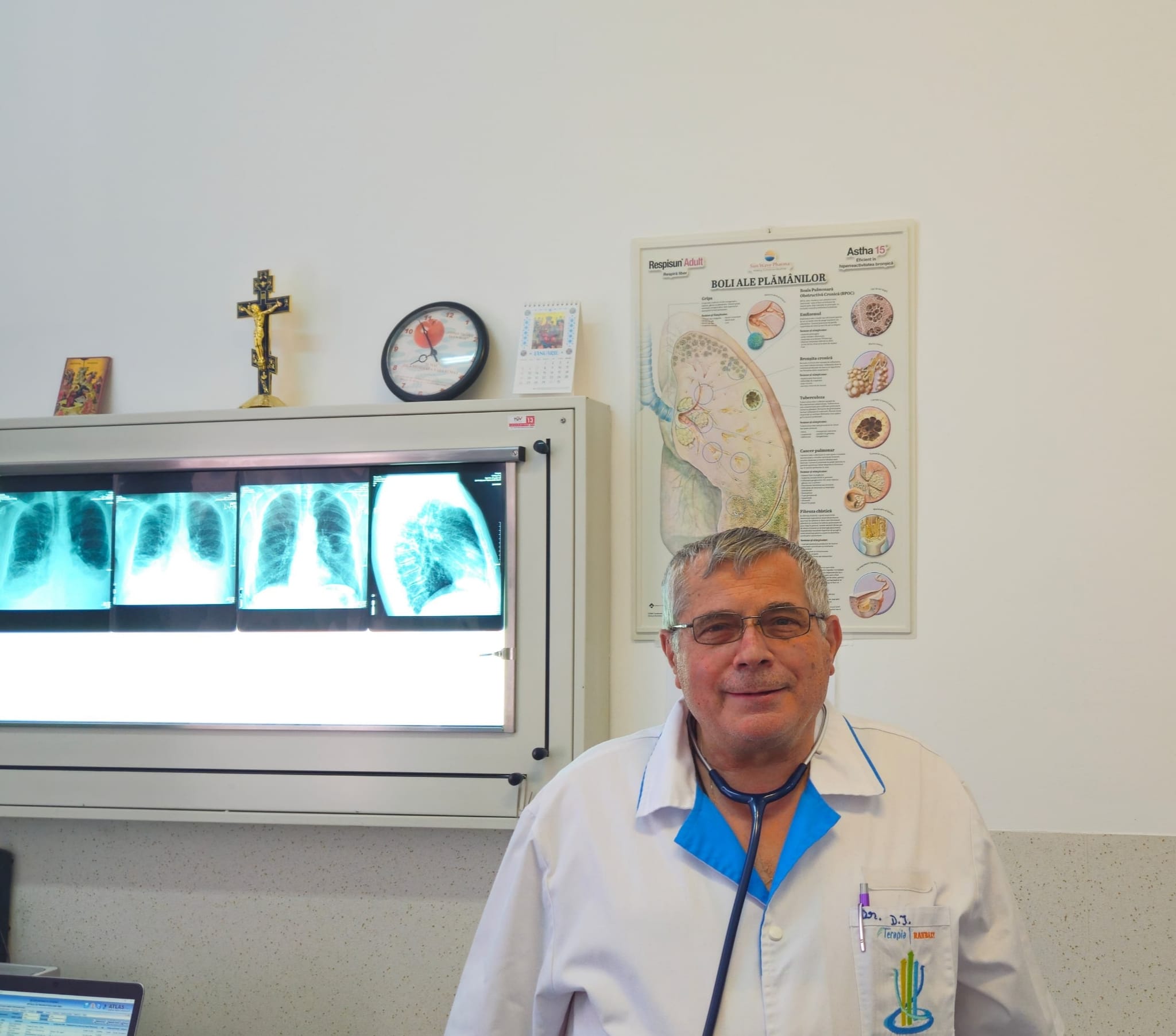 Os de peste un centimetru extras din plămânul unui pacient la Spitalul de Pneumoftiziologie Sibiu