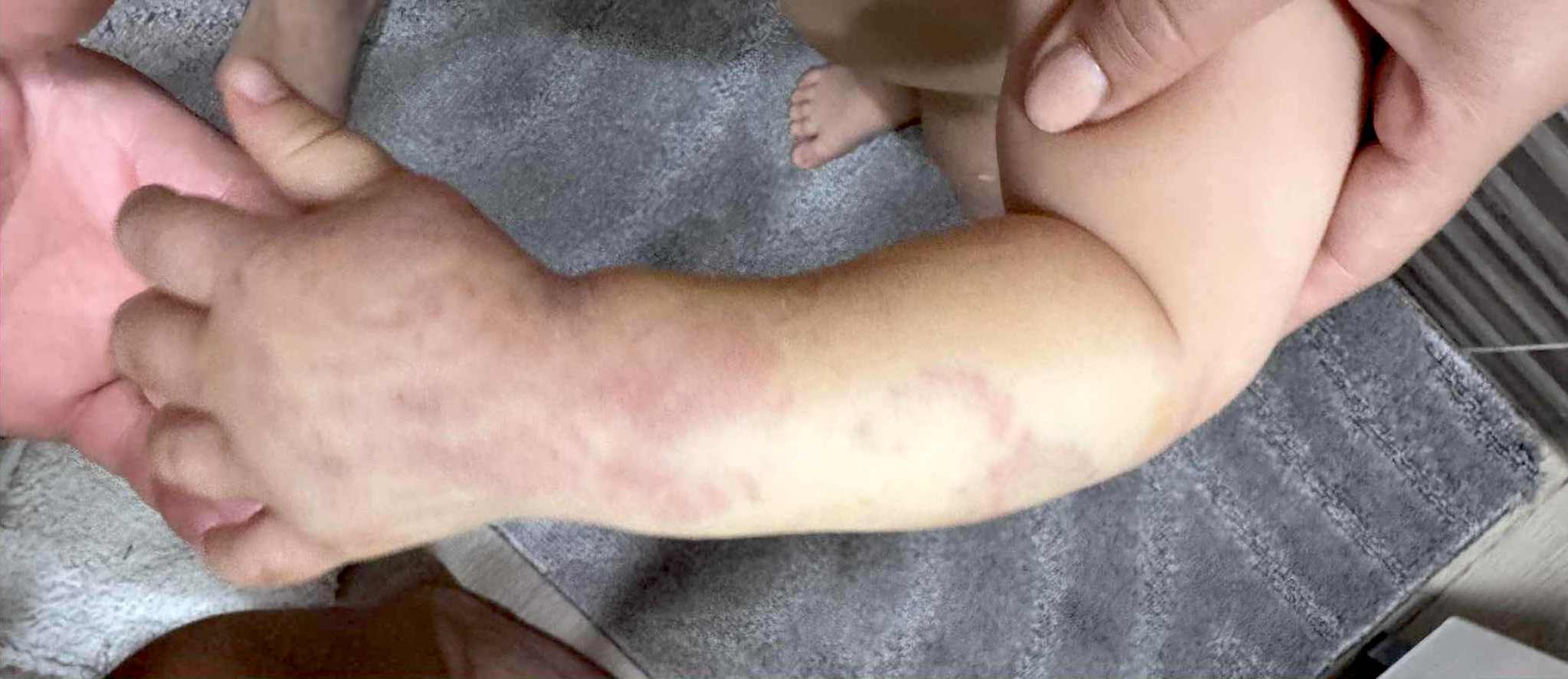 Incident la o creșă privată din Sibiu. O fetiță de doi ani, rănită la mână. Poliția și Protecția Copilului fac anchete. Nu este o unitate acreditată