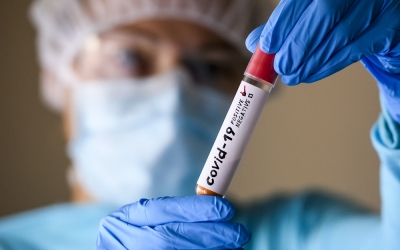 324 de sibieni au fost diagnosticați cu Covid-19, în ultima lună. DSP Sibiu: „Medicii nu au raportat simptome specifice, altele decât cele deja cunoscute”