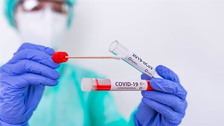 test-coronavirus-covid-7fks