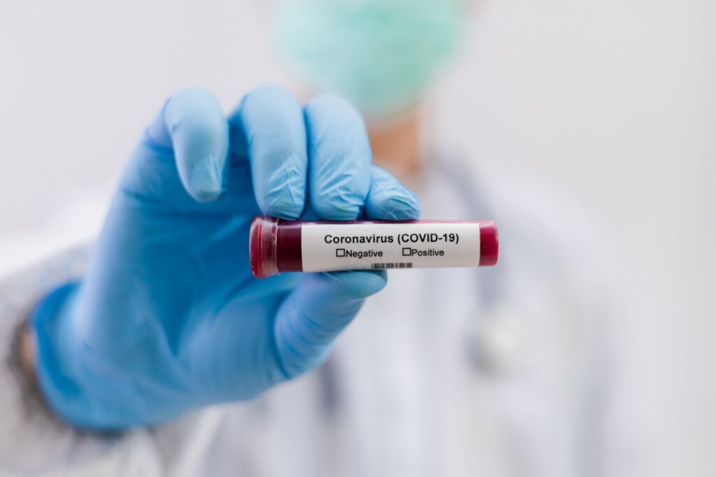 Coronavirus (COVID-19) testng concept, The doctor holds a test t