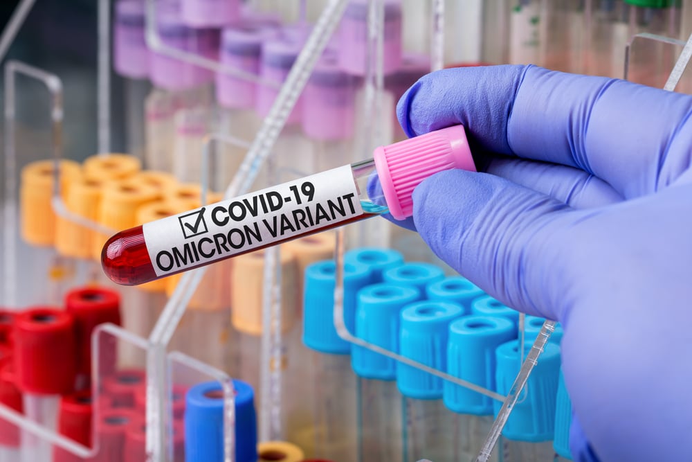 Technician lab with blood sample of New Variant of Covid-19 call