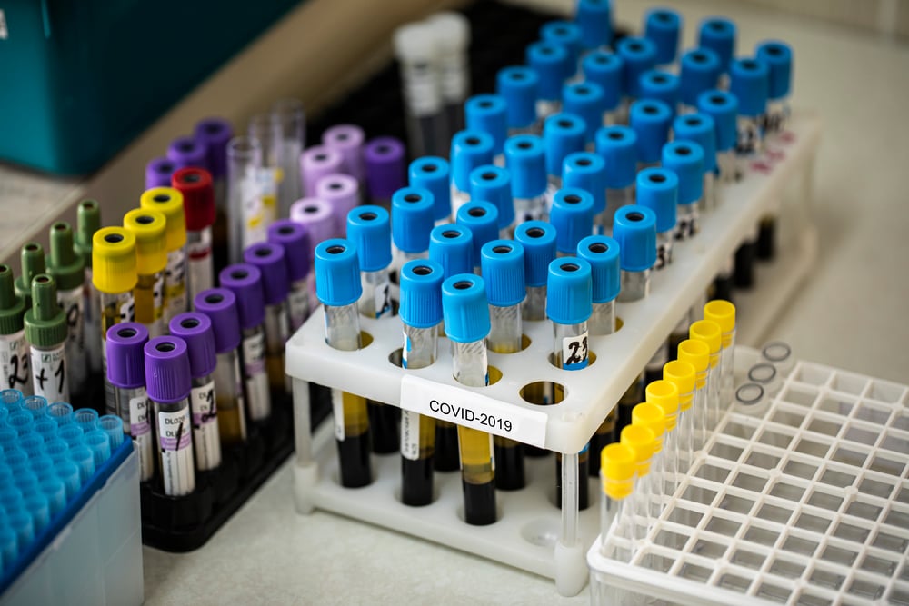 Holders with tubes of biological samples contaminated by Covid-19. Laboratory