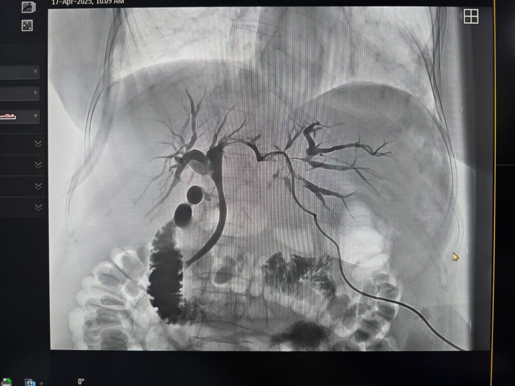 interventie-in-premiera-radiologie-ati-gastro-foto-spital-2-qz0s