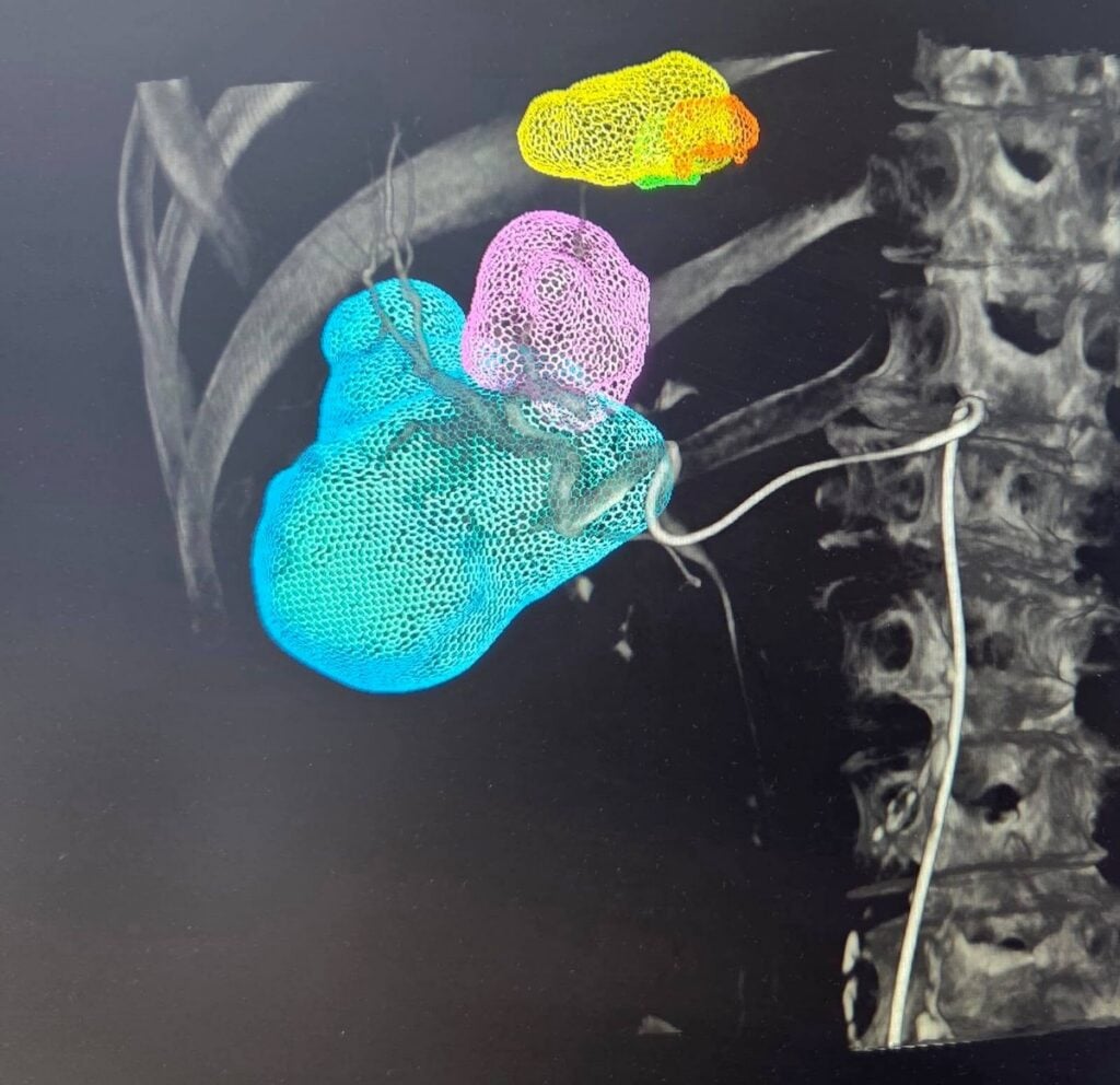interventie spital foto facebook judetean1