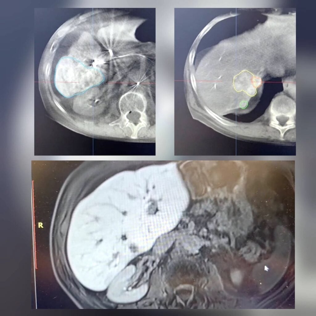 interventie spital foto facebook judetean2