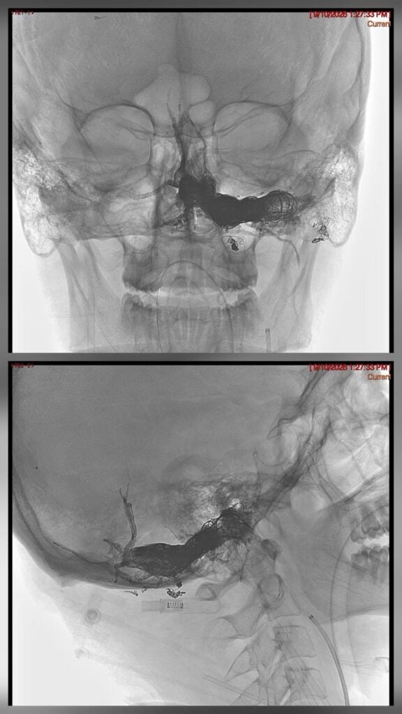 Foto Neuroradiologie Intervențională Sibiu
